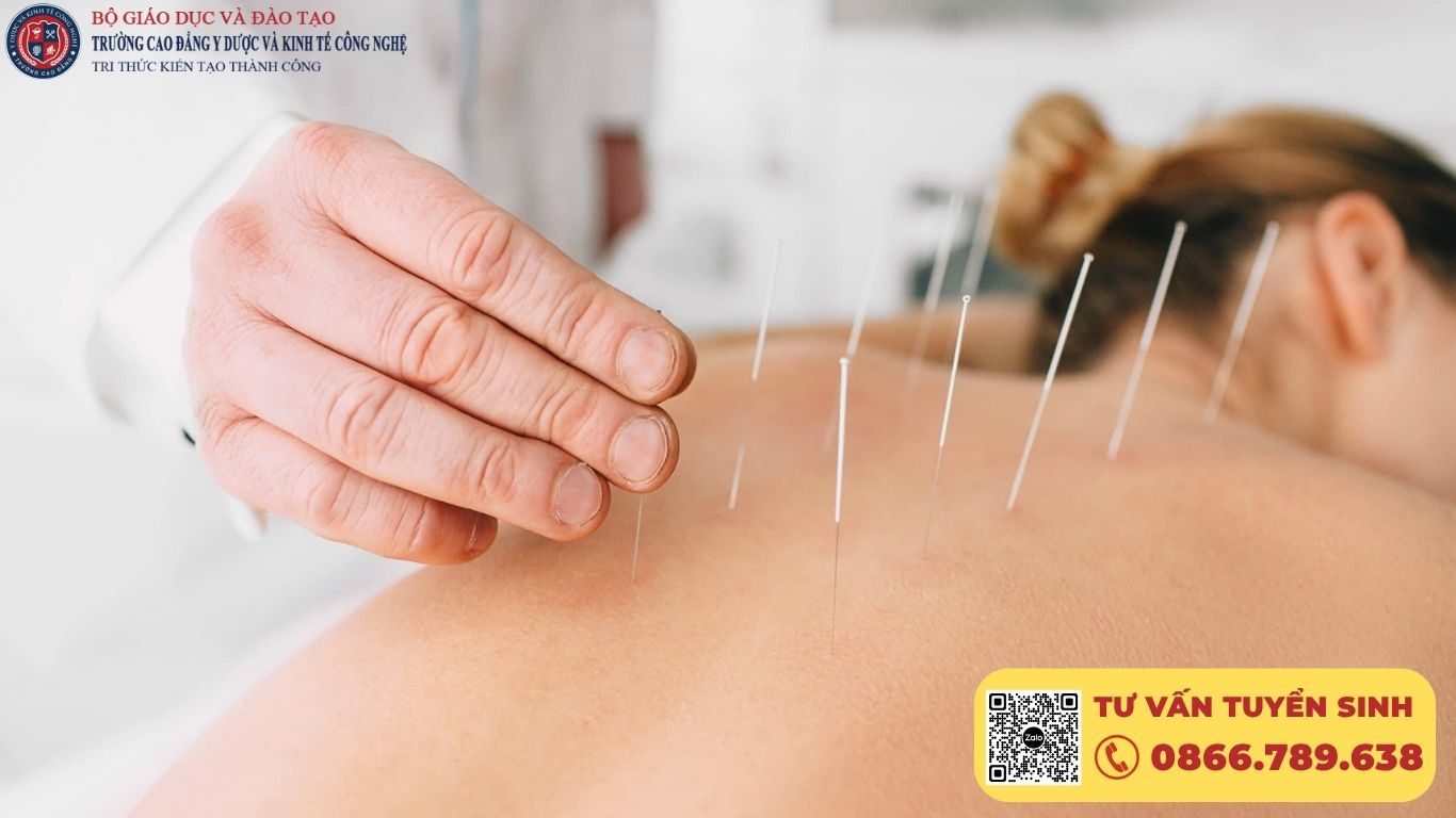 NỘI DUNG CHI TIẾT KHÓA HỌC CHÂM CỨU – CHƯƠNG TRÌNH ĐÀO TẠO