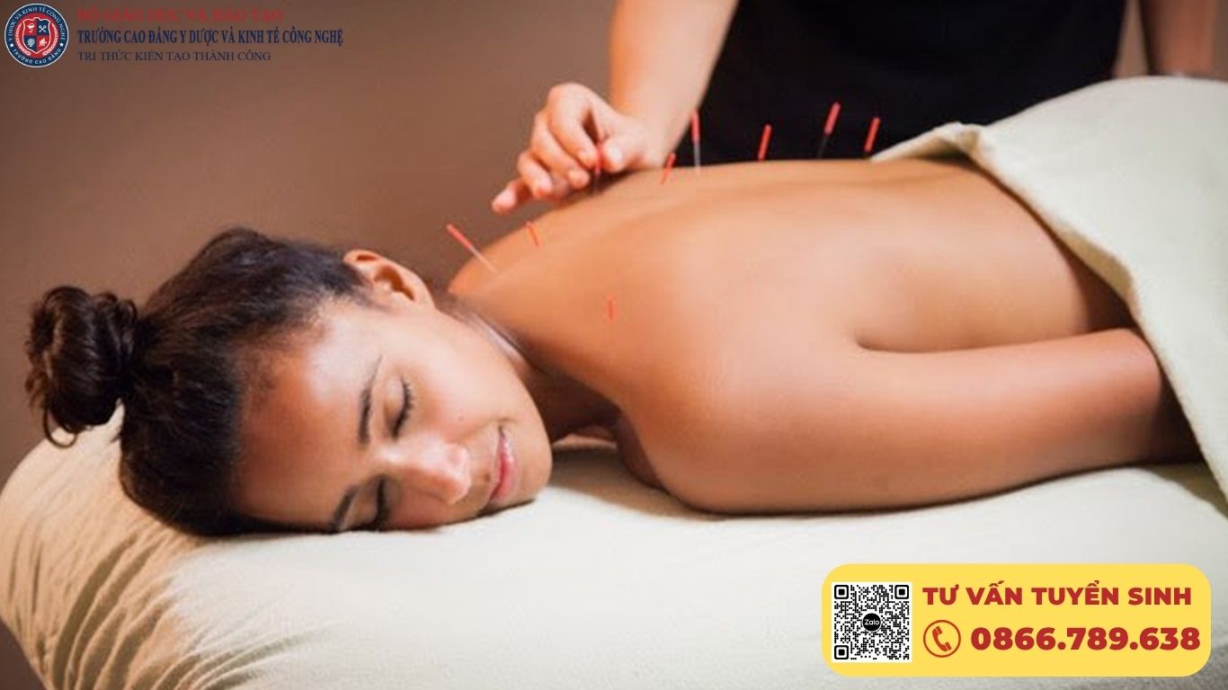 KHÓA HỌC CHÂM CỨU DÀNH CHO AI? – ĐỐI TƯỢNG & ĐIỀU KIỆN ĐẦU VÀO