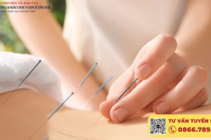 Khoá học châm cứu cơ bản, cấp chứng nhận sau khoá học