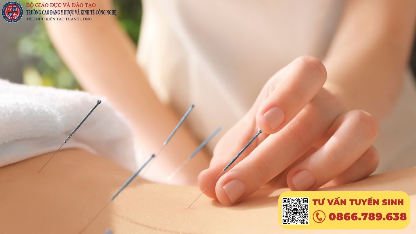 Khoá học châm cứu cơ bản, cấp chứng nhận sau khoá học