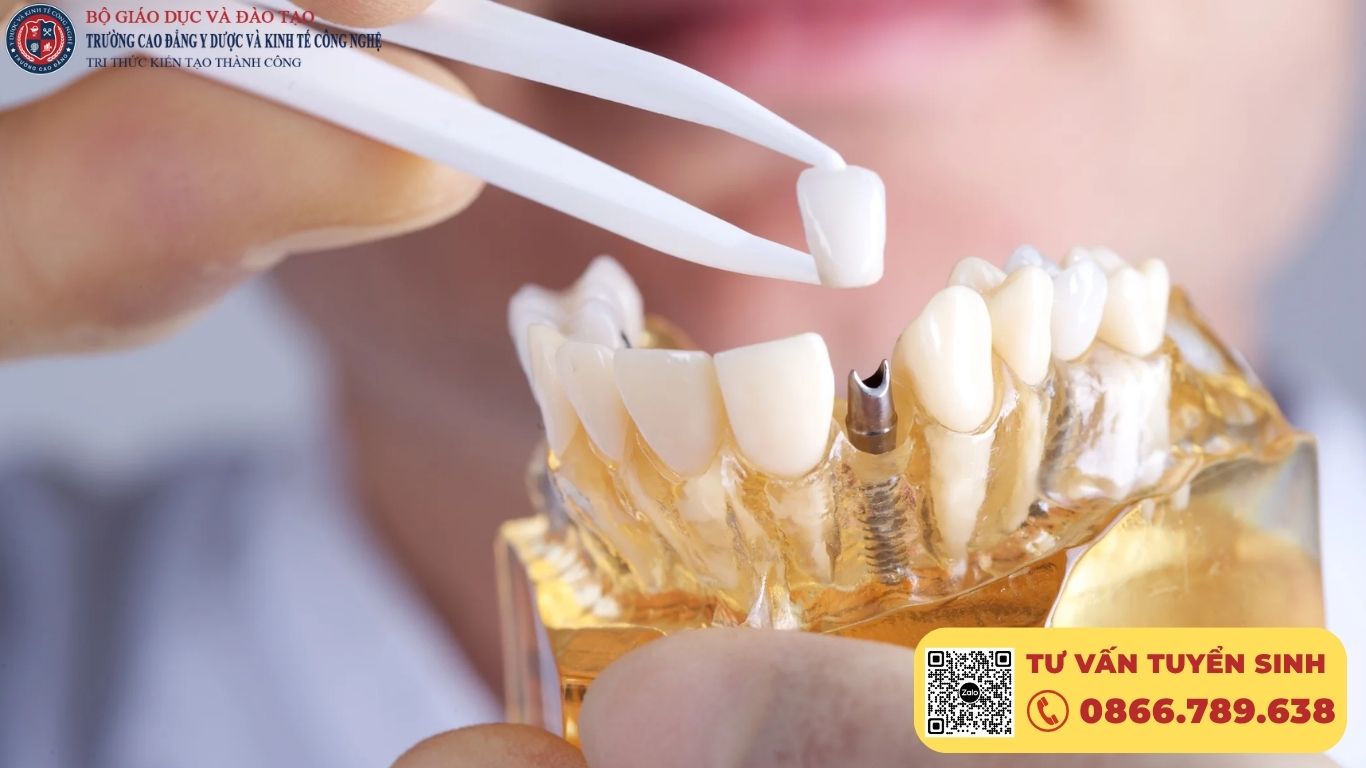 Phương thức xét tuyển ngành Răng Hàm Mặt năm 2026